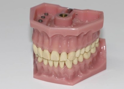 Dentures and Why you Might Need Them
