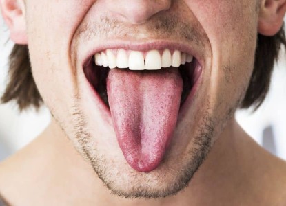 How To Deal With Oral Thrush?